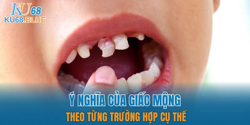 Luật Chơi Đá Gà Mới Nhất 2025 - Dân Chơi Phải Biết 6 4 trường hợp mộng thường gặp mà bạn nên biết